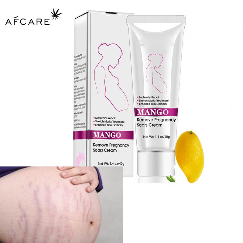 Wholesale High Quality Stretch Mark Removal Cream Ice Body Cream