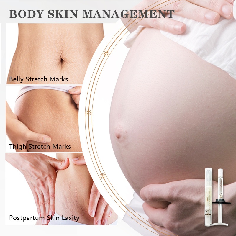 a Private Label Stretch Mark Cream Treatment Repair for Pimples Acne Scar Removing Tummy Tuck Stretch Mark Cream