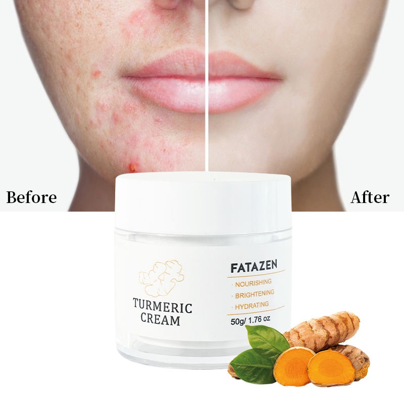 Wholesale Skin Care Products Anti Aging Moisturizer Face Whitening Cream OEM Anti Wrinkle Acne Vitamin C Turmeric Facial Cream
