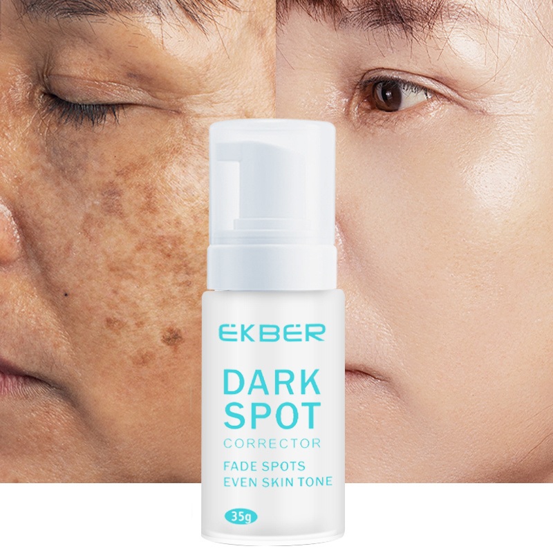 Wholesale Best Skin Care Whitening Face Care Removal Dark Spot Corrector Face Cream Treatment Cosmetic Skin Care Beauty Products Lightening Cosmetics Remove