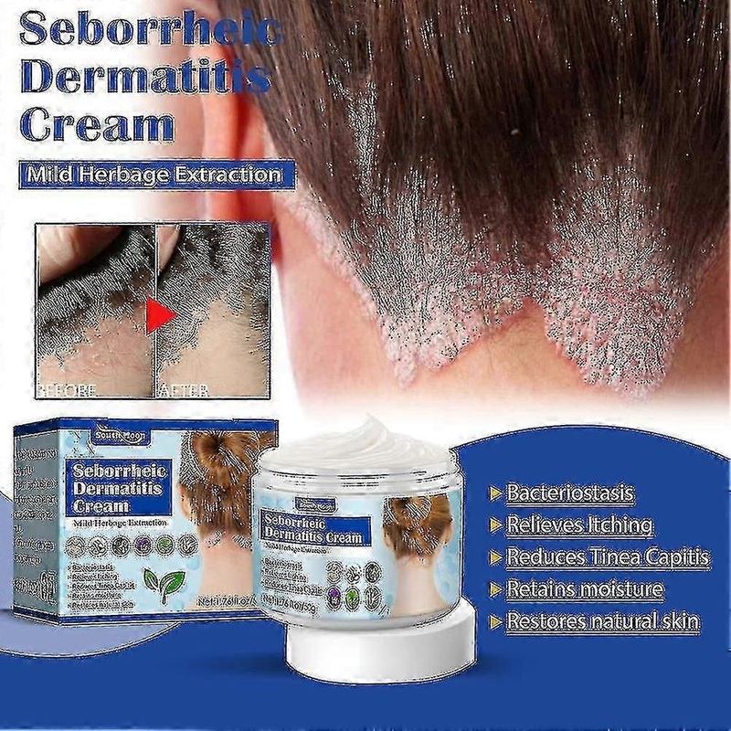 3pcs Seborrheic Dermatitis Cream Scalp For Psoriasis Eczema-moisturizing